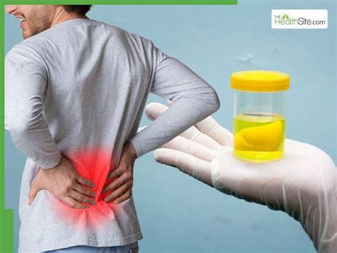 Kidney Damage Symptoms In Urine At Night: Foamy Urine And 5 Other Signs ...