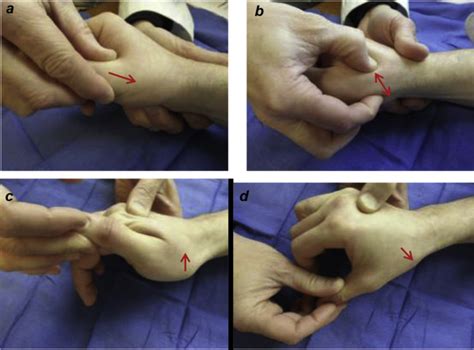 The diagnostic clinical value of thumb metacarpal grind, pressure-shear, flexion, and extension ...