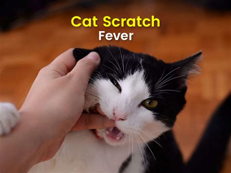 All You Need To Know About Cat Scratch Fever: Symptoms, Causes, Treatment, Diagnosis, Prevention ...