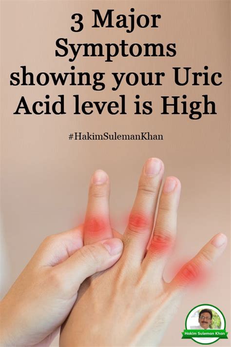 3 major symptoms showing your uric acid level is high – Artofit
