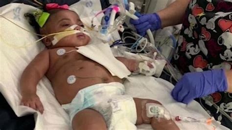 Judge Orders Hospital to Keep 9-Month-Old Girl on Life-Support as Her ...