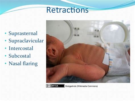 GEMC: Pediatric Respiratory Distress: Resident Training