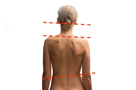 Why Your Spine Goes Out of Alignment? • Collins Chiropractic Health ...