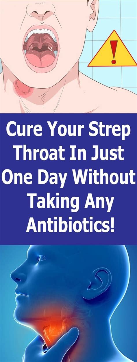 Cure Your Strep Throat In Just One Day Without Taking Any Antibiotics!!!