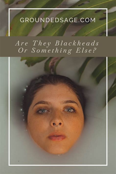 Are they blackheads or Something Else like Sebaceous Filaments? - Grounded Sage | Sebaceous ...