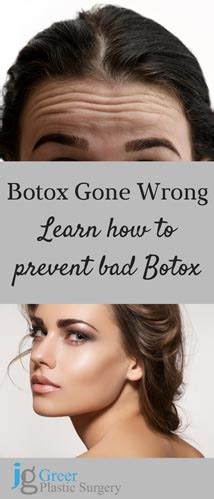 When Botox Gone Wrong | Why Does Bad Botox Happen?