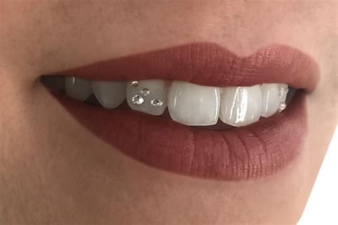 Dental Jewelry, Teeth Jewelry, Piercing Jewelry, Triple Forward Helix Piercing, Grillz Teeth ...