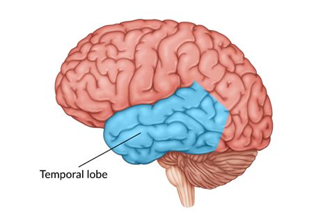 Temporal Lobe Stroke: Causes, Secondary Effects, & Recovery