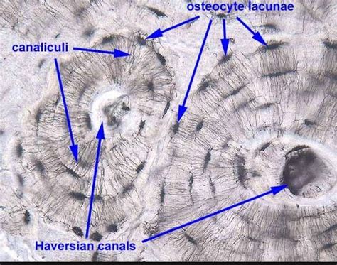 Osteocyte Apoptosis and Associated Pathologies |Genetic Engineering Info