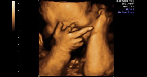 HowToBeADad.com – Funny Ultrasounds Only a Parent Could Love