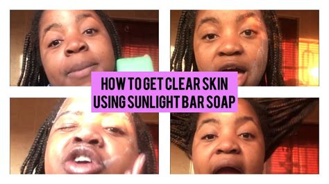 How to get clear skin using sunlight bar soap 🧼 || Skin care tips || - YouTube