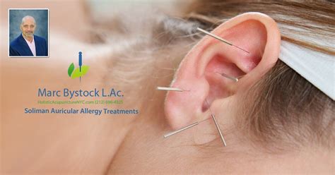 Soliman Auricular Allergy Treatments NYC by Marc Bystock L.Ac.