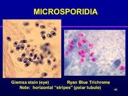 Microsporidia | Microbiology, Stain, Polar