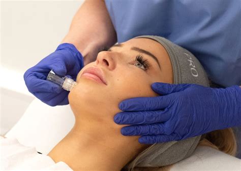SkIN-TOX Microinfusion Facial | Anne Hegarty Cosmeticare