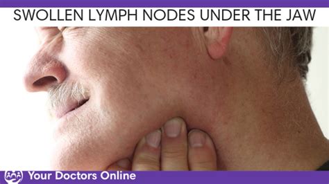 Swollen Lymph Nodes Jaw | Images and Photos finder