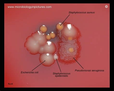 Pseudomonas Aeruginosa Colony Morphology