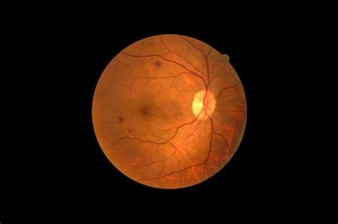 Ideas, Inventions And Innovations : New Artificial Retinas Based on 2D Materials