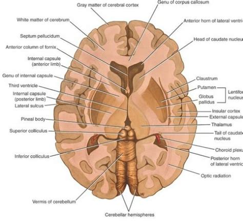 Corte transversal encéfalo | Brain Anatomy Study