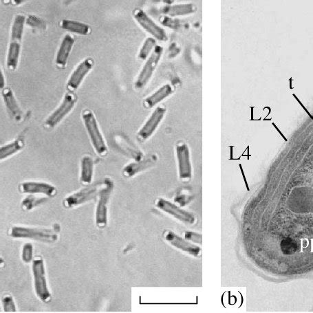 Morphology and ultrastructure of Synechococcus bigranulatus 0431 cells:... | Download Scientific ...