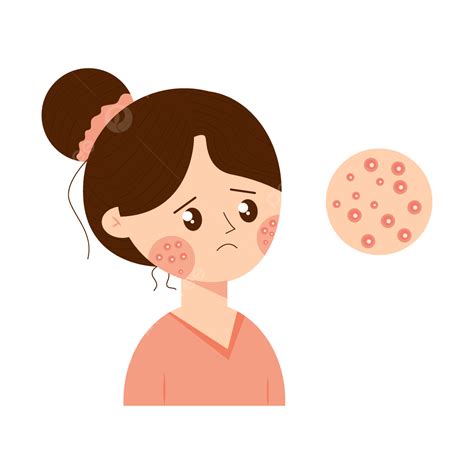 Cartoon Facial Acne Transparent Background Png Clipart Hiclipart | The Best Porn Website