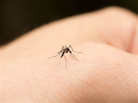 Mosquito Bite Allergy: Skeeter Syndrome Symptoms, Explained | SELF