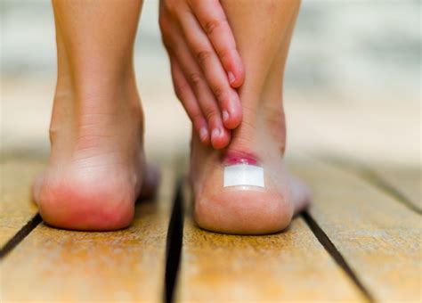 Have a Blister on Your Foot? Here's How to Treat It - Foot and Ankle Group