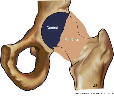 Anatomia De La Cadera - smashtrust