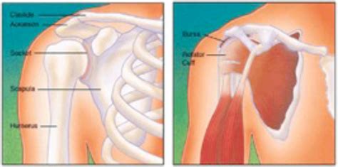 Rotator Cuff Injury: Physical Therapy and Surgery