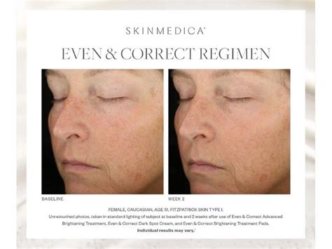 SkinMedica Even & Correct Treatment Pads - On Sale! Order Now.