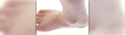 Prevention of synovitis | Musculoskeletal Issues articles | Body & Health Conditions center ...