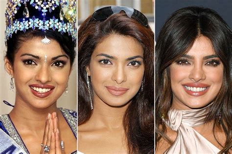 Priyanka Chopra Opens Up About Getting a Botched Nose Surgery