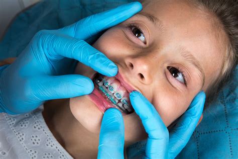 Children’s Orthodontist | Fulham Road Dental