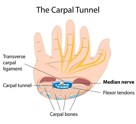 Carpal Tunnel Syndrome | Physiotherapy Treatment Singapore. Fast pain relief. Time for a fuller ...