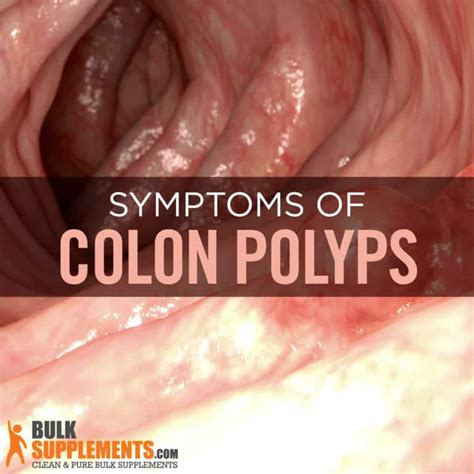 what do colon polyps look like Archives