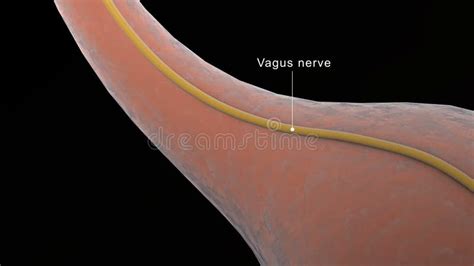 Animation of a Vagotomy Surgical Procedure To Remove Part of the Vagus Nerve Stock Footage ...