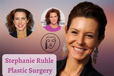 Did Stephanie Ruhle Have Plastic Surgery? Before And After Photos