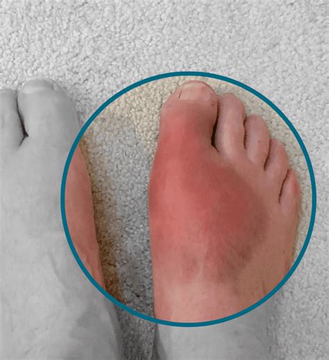 Diabetic Foot | Perfect Skin Solutions | Southsea | Aesthetics