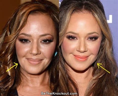 Leah Remini Plastic Surgery Comparison Photos