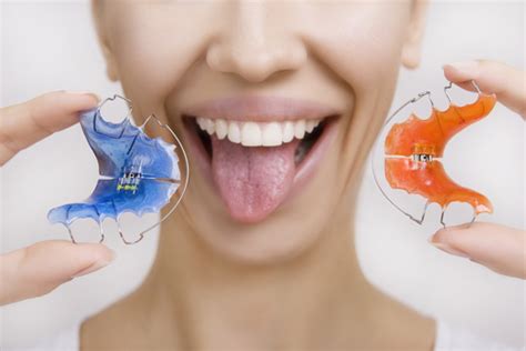 3 Things to Know About Orthodontic Appliances - Soleil Orthodontics