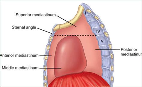 Carcinoma of the Mediastinum - Introduction, Etiology and Pathology, Symptoms | health.am