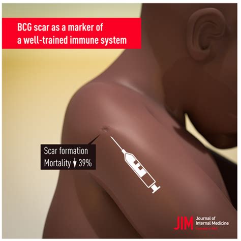 BCG scarring and improved child survival: a combined analysis of studies of BCG scarring - Benn ...