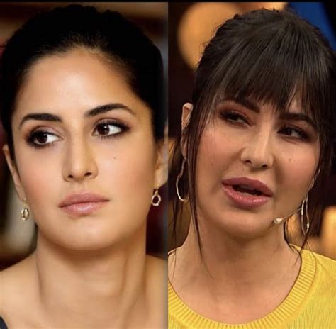 Katrina Kaif Ruined Her Beautiful Face Through Plastic Surgery – – My ...