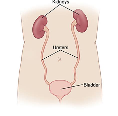 What Is Cystectomy? | Urology Specialist