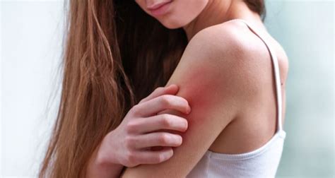 Skin Allergy Types - The Different Types Of Skin Allergies