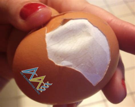 Natural Eggshell Membrane (NEM) - Rebuild Cartilage | AAI Clinic