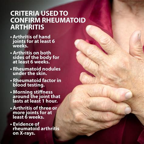 Rheumatoid Arthritis Of The Hand | Florida Orthopaeidic