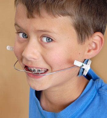 Orthodontic Headgear - Dentist Bethlehem, PA - Dental Education Library