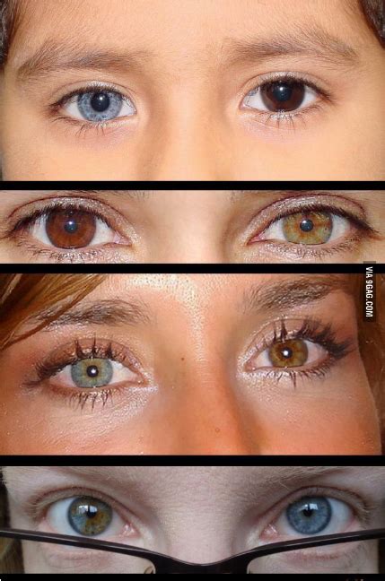 คนอินเดียนัยตาสี Heterochromia สีตาที่แปลกที่สุดในโลก