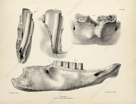 Mylodon prehistoric mammal fossil teeth, 19th century - Stock Image - C040/0845 - Science Photo ...