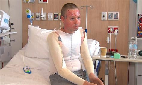 Survivor of alleged brutal Newcastle attack speaks out – NBN News